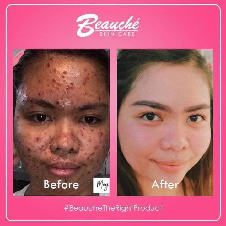 Beauche Beauty Set (Dark pink)