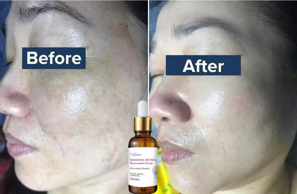 Venature Bakuchiol Retinol Rejuvenation Serum -30ml