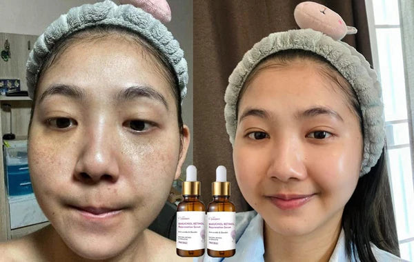 Venature Bakuchiol Retinol Rejuvenation Serum -30ml