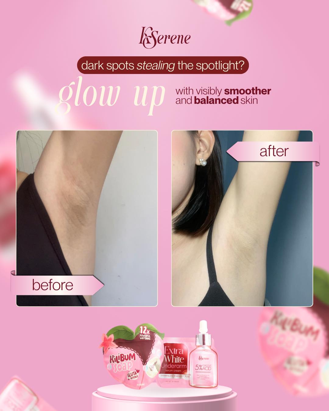 Kserene Extra White Underarm Serum Cream 30g