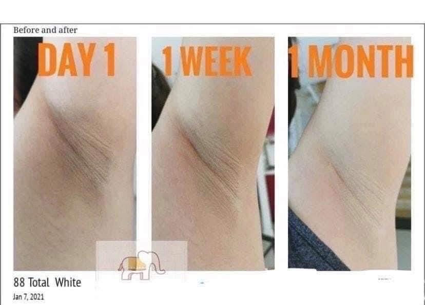 88 Total White Underarm Cream