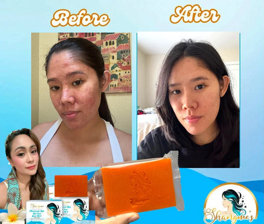 Shangme Organic niacinamide all in 1 miracle soap face&body all skin types kids and adults.(135grams)