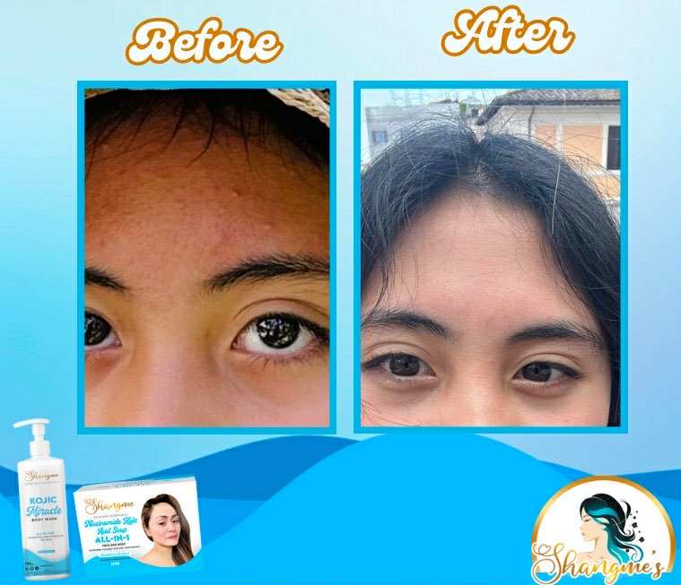 Organic niacinamide all in 1 miracle soap face&body all skin types kids and adults.(135grams)