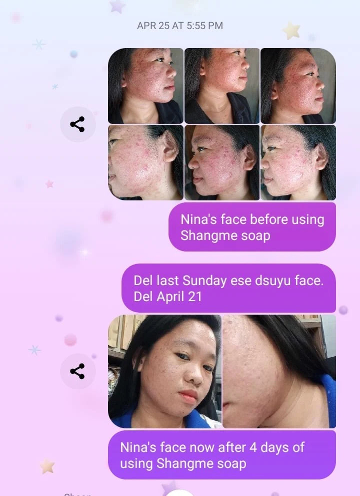 Organic niacinamide all in 1 miracle soap face&body all skin types kids and adults.(135grams)