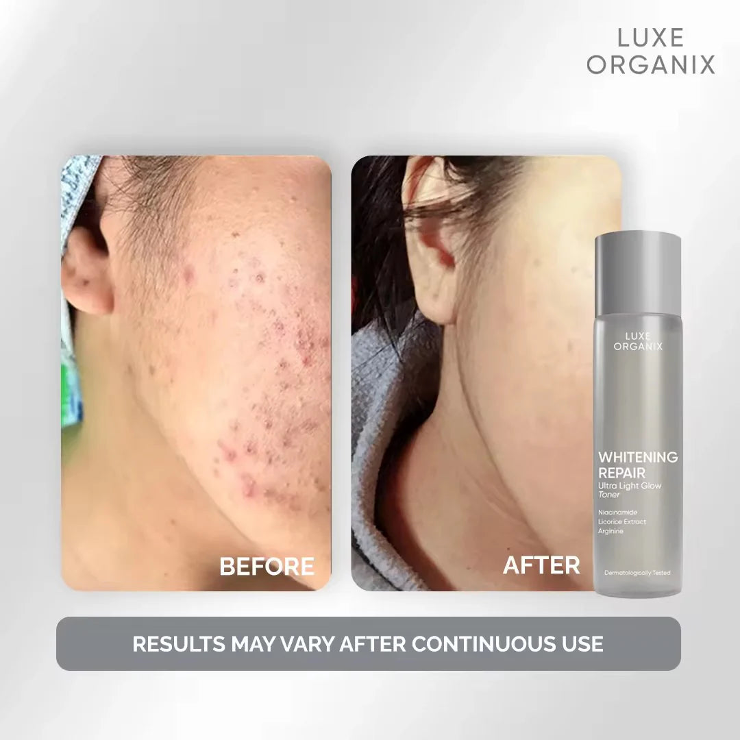 Luxe Organix - Whitening Repair Ultra Light Glow “TONER” 150ml - ( Gray Bottle )
