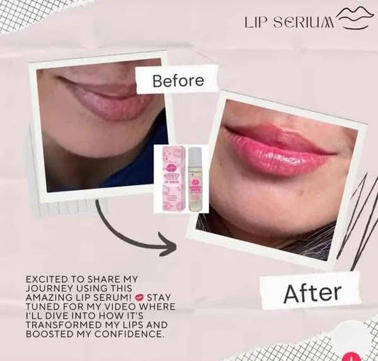 K-Beauty Sweet Kiss LIP SERUM 10 ML