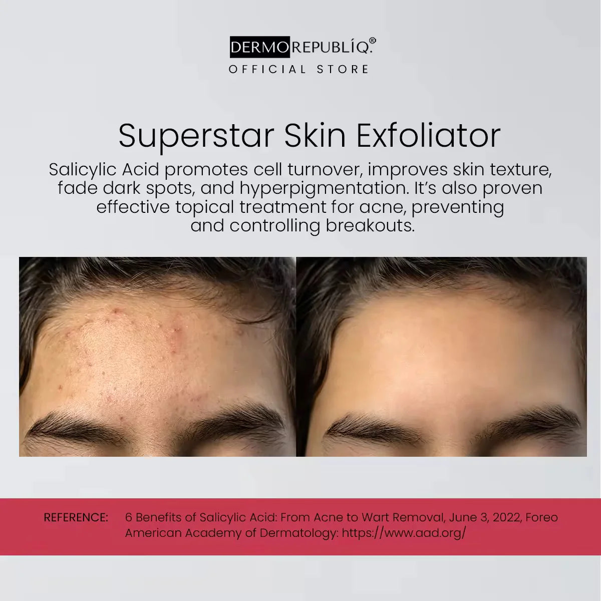 DERMOREPUBLIQ - TONER 7% Glycolic ( AHA ) Skin Renewing Solution ( TONER ) 100ml