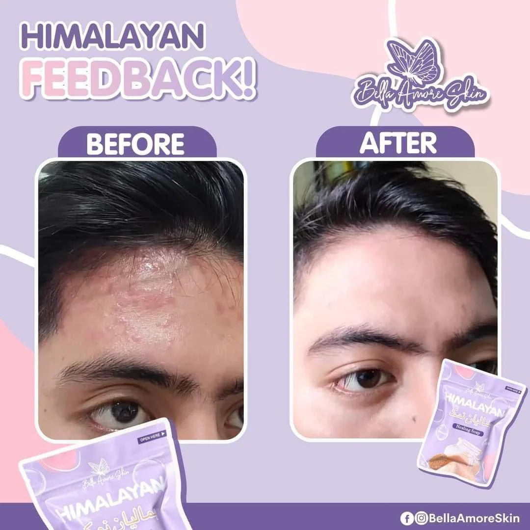 Bella Amore Skin - Himalayan Soap 130 g