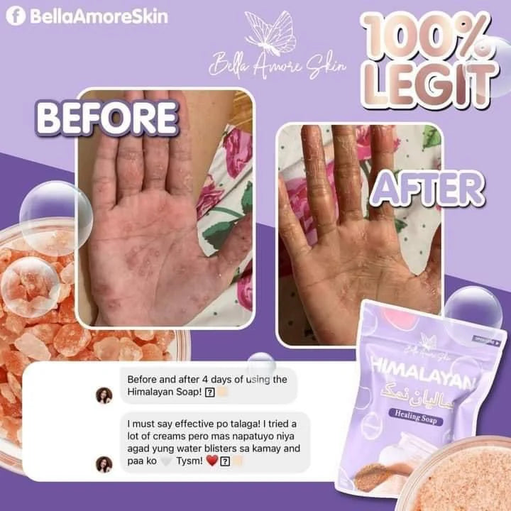 Bella Amore Skin - Himalayan Soap 130 g