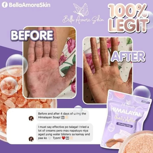 Bella Amore Skin - Himalayan Soap 130 g