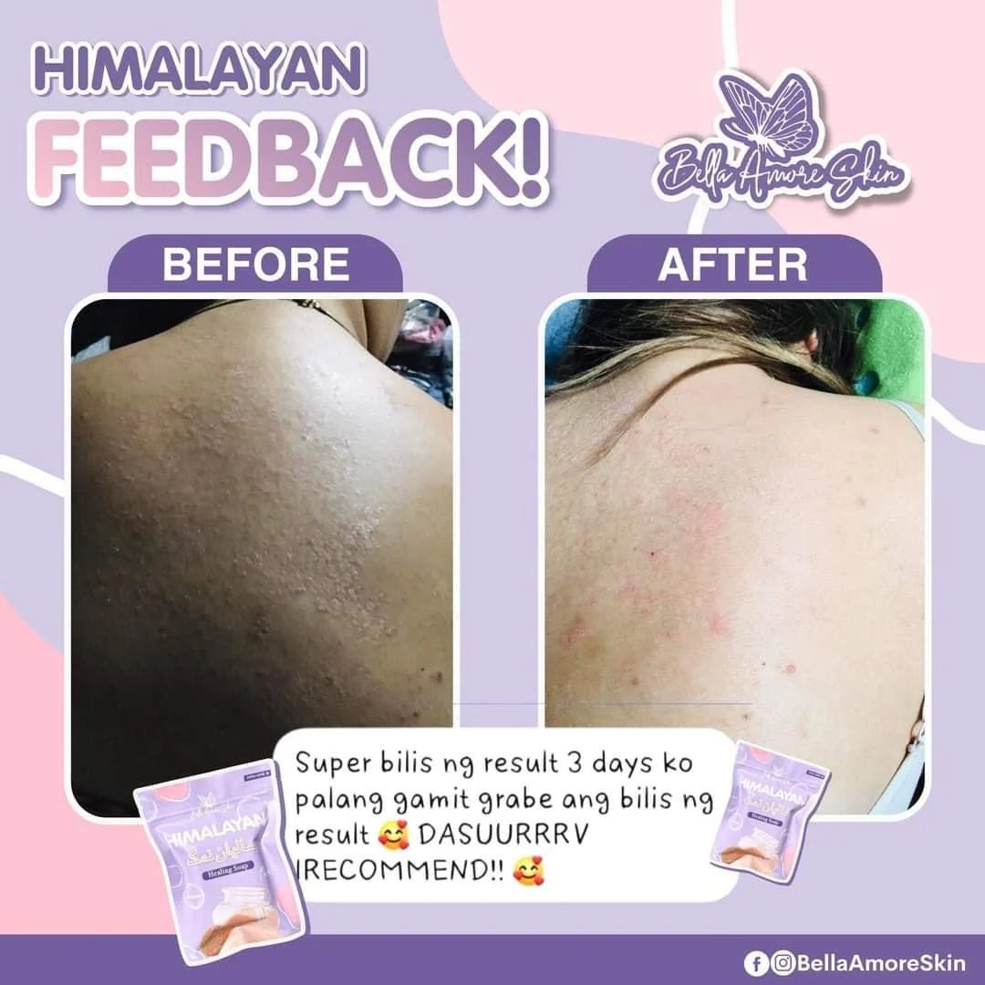 Bella Amore Skin - Himalayan Soap 130 g