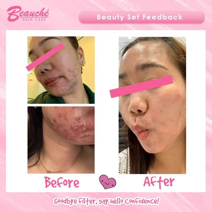 Beauche Beauty Set (Dark pink)