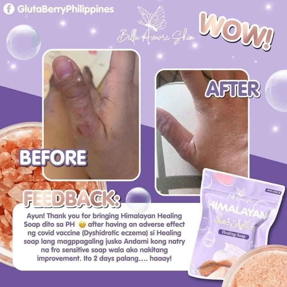 Bella Amore Skin - Himalayan Soap 130 g