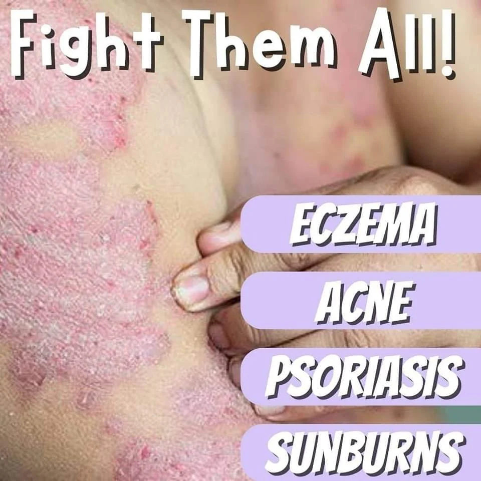 Bella Amore Skin - Himalayan Soap 130 g